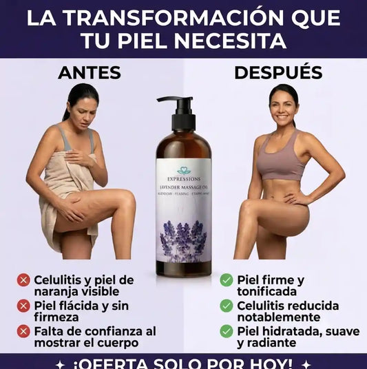 CelluLift™ | Reduce la celulitis, reafirma la piel y activa la circulación