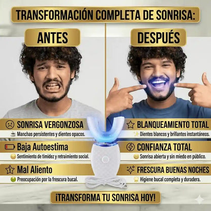 DentGlow ™️| Potencia tu sonrisa y confianza diaria con tecnología ultrasónica