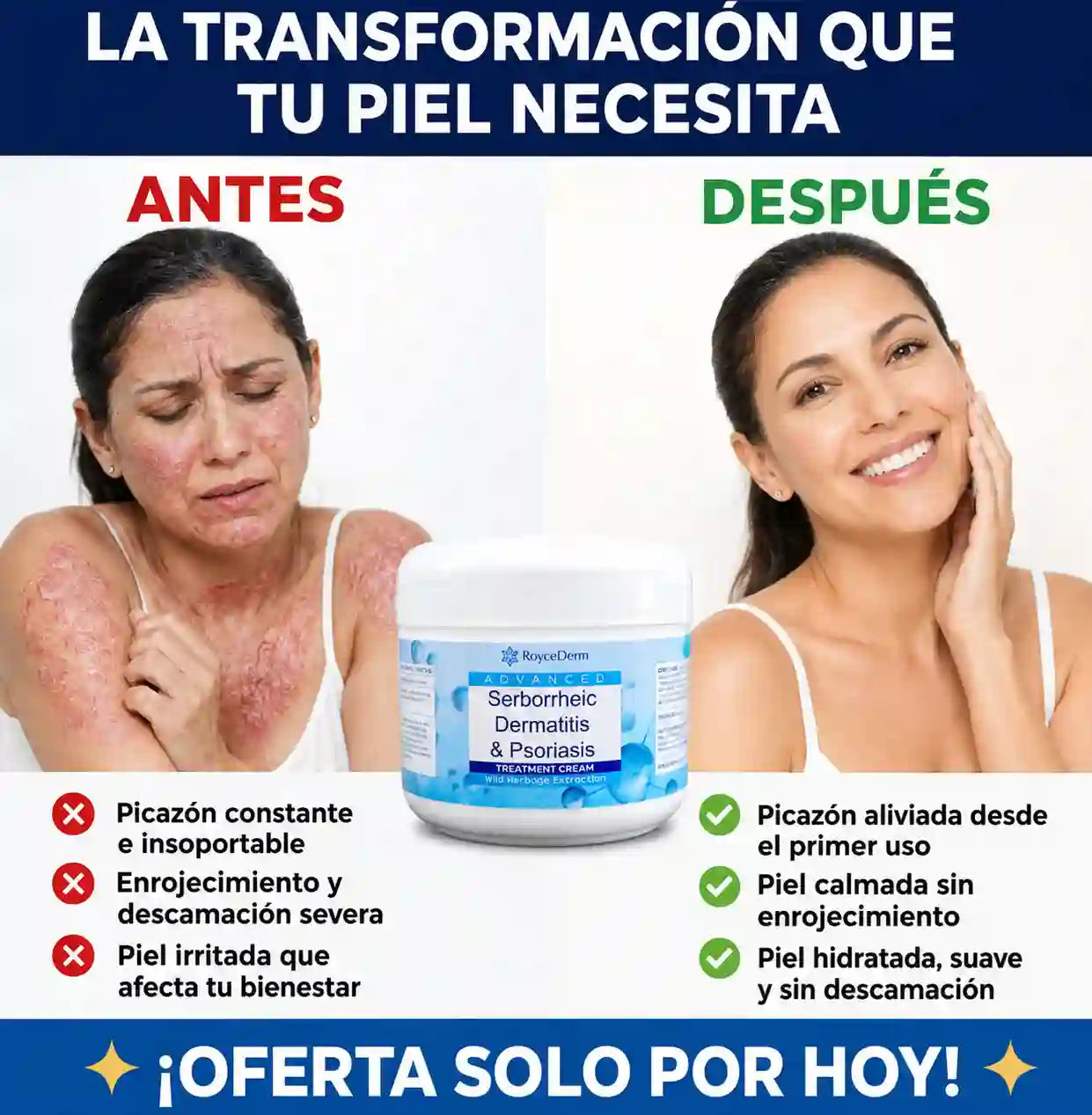 RoyceDerm™ | Alivia la picazón, controla la descamación e hidrata tu piel