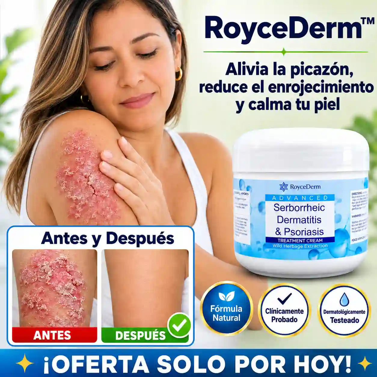 RoyceDerm™ | Alivia la picazón, controla la descamación e hidrata tu piel
