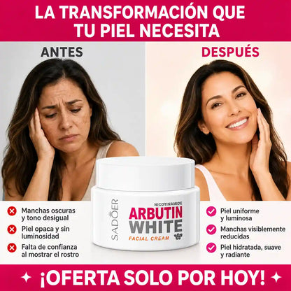 LumiSkin™ | Aclara manchas, unifica el tono y devuelve la luminosidad a tu piel