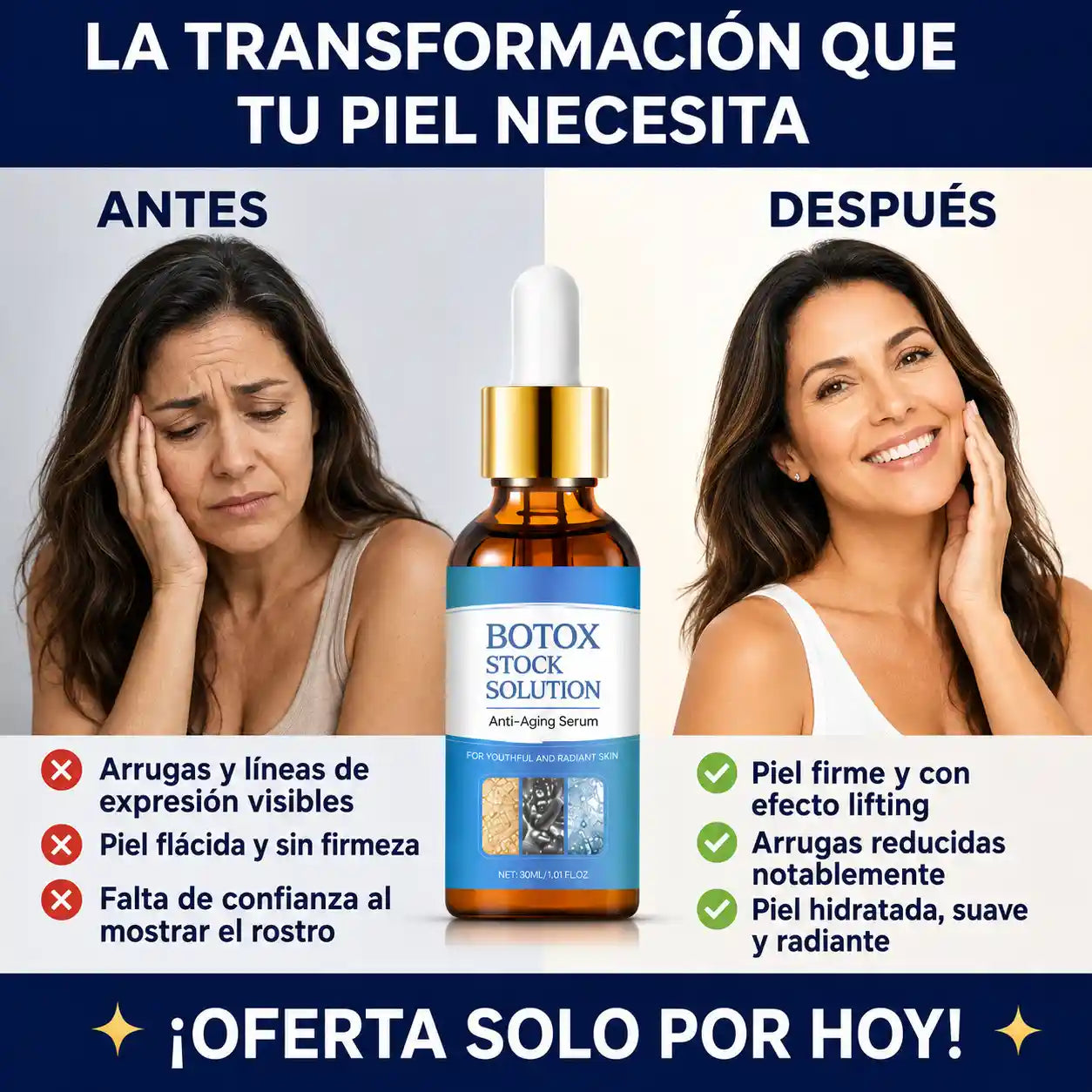 BotoxSolution™ | Reduce arrugas, rellena líneas finas y rejuvenece tu piel sin agujas