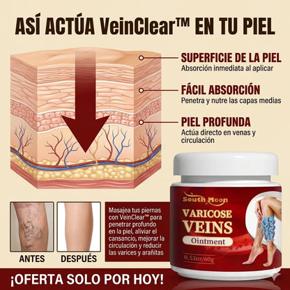 VeinClear™ |  Reduce la hinchazón, el cansancio y las venas visibles