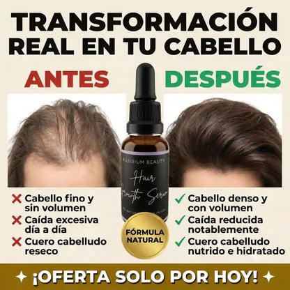 GrowMax™ | Estimula el crecimiento, reduce la caída y fortalece el cabello