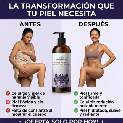 CelluLift™ | Reduce la celulitis, reafirma la piel y activa la circulación