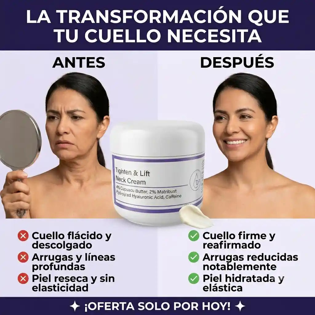 NeckLift™ | Reafirma el cuello, reduce la flacidez y las arrugas