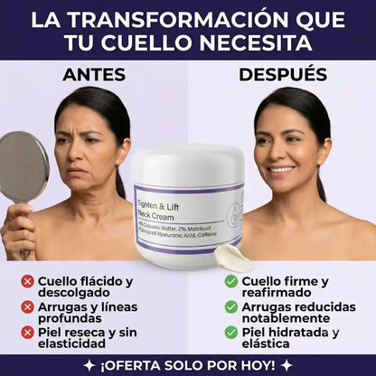 NeckLift™ | Reafirma el cuello, reduce la flacidez y las arrugas