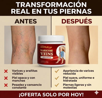 VeinClear™ |  Reduce la hinchazón, el cansancio y las venas visibles
