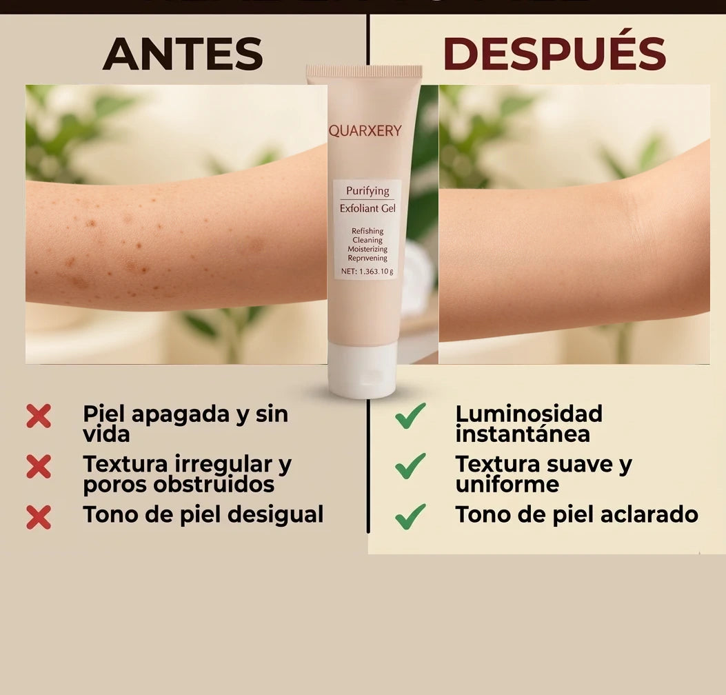 Quarxery™ — comparación corporal de impurezas y apariencia más uniforme