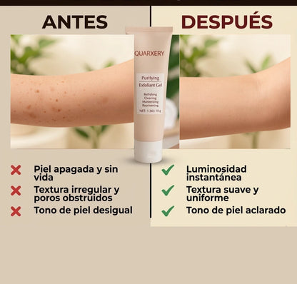 Quarxery™ — comparación corporal de impurezas y apariencia más uniforme